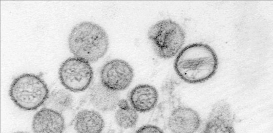 Hantavirus Muncul di China, Lebih Berbahaya daripada Corona Covid-19?