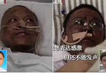 Setelah Sembuh dari Virus Corona COVID-19, 2 Dokter di Wuhan Menghitam