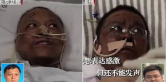 Setelah Sembuh dari Virus Corona COVID-19, 2 Dokter di Wuhan Menghitam