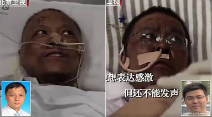 Setelah Sembuh dari Virus Corona COVID-19, 2 Dokter di Wuhan Menghitam