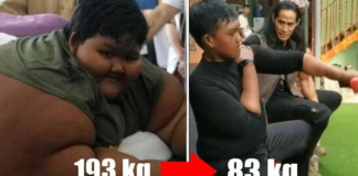 Luar Biasa! Arya Permana Bocah Yang Dulu Viral Karena Obesitas Mencapai 192kg , Sekarang Sudah jadi 83kg, Bisa Beraktifias Lari Dll
